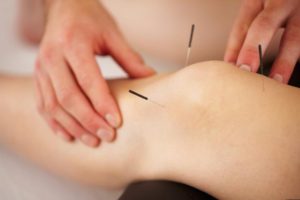 Sports medicine acupuncture